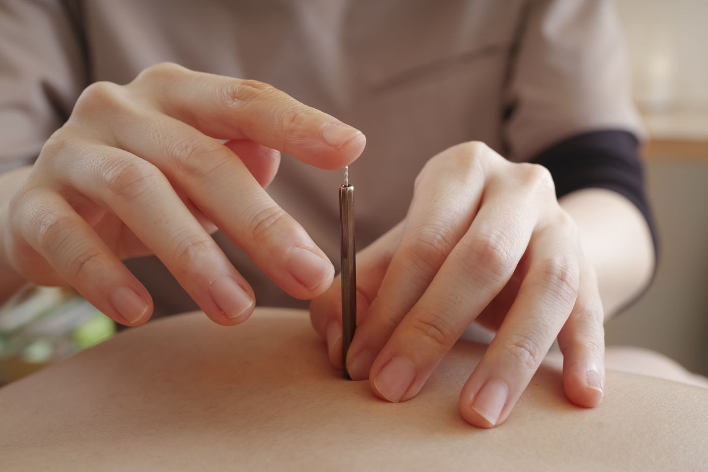 まとめイメージ｜鍼灸治療